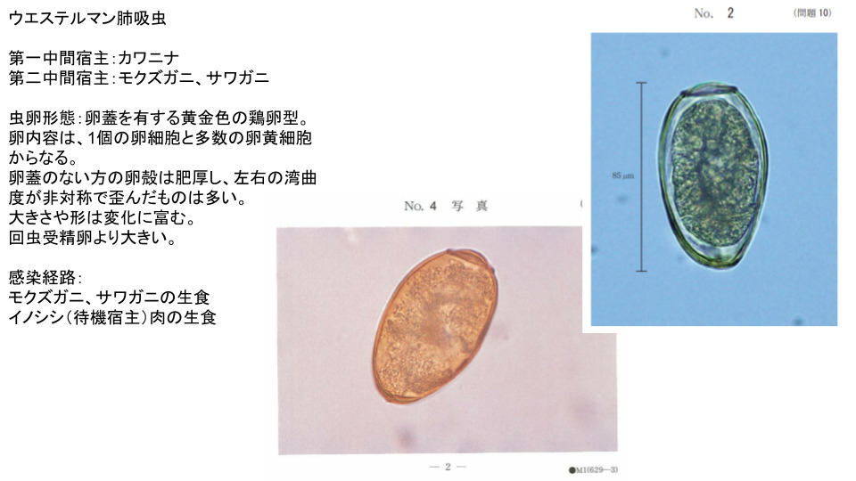 臨床検査技師国家試験に出題された寄生虫の虫卵一覧【医動物学】 - SAI